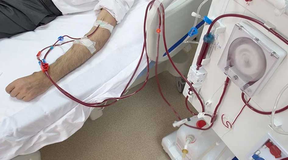 Kidney Dialysis